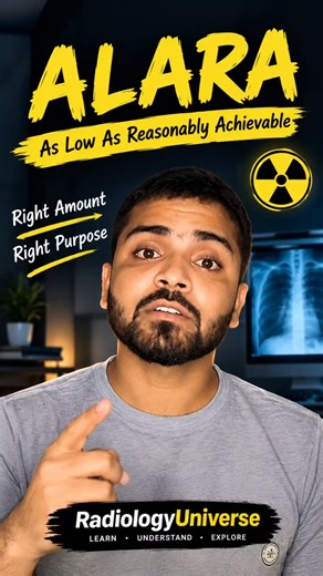 ALARA Explained in 45 Seconds ☢️ | The Golden Rule of Radiation Safety#radiology#radiographer#upums