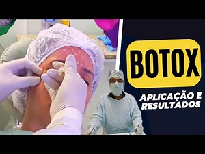 BOTOX - Aplicação e resultados
