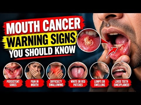 6 Mouth Cancer Warning Signs You Should Never Ignore | Early Symptoms