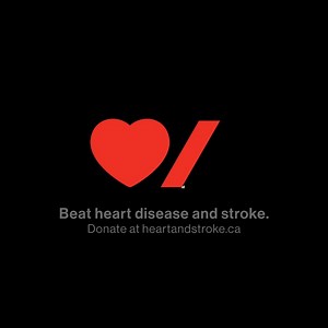 In a time where treatment and reversing stroke was considered impossible, Dr. Michael Hill co-led the ESCAPE trial (endovascular treatment [EVT] for ischemic stroke). Today, this breakthrough research gives those who have experienced a stroke another chance at life. Learn how research turns barriers into breakthroughs. #BeatStroke | Heart & Stroke