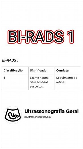 BI-RADS 1- Exame normal