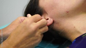 Doctor putting acupuncture needles in the ear. Chinese Traditional Medicine.
