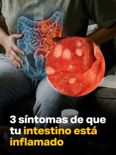 3 síntomas de que tu intestino está inflamado | @soyfelipeoficial | signs of infection