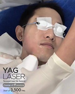 41K views | 50% off Laser Hair Removal | Get Softer, Smoother Skin...