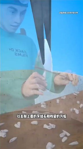 🦷 What Really Happens During a Tooth Extraction ?