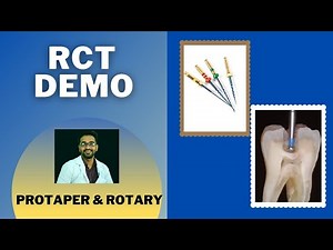 RCT DEMO USING HAND PROTAPER AND ROTARY FILES