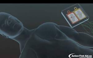 AED（自动体外除颤仪）工作原理