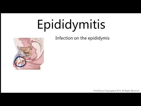 Epididymitis