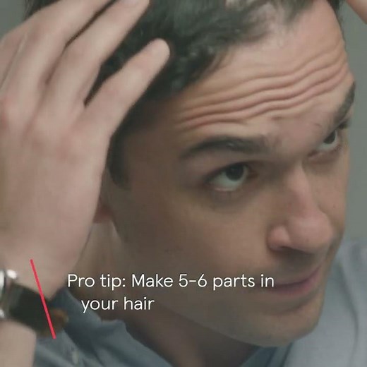 How to Apply Your Minoxidil Solution for Hair Loss