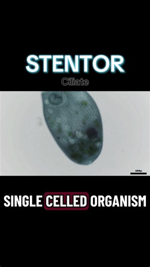 This is a TikTok of a microorganisms called a stentor. Stentors are single celled organisms primarily seen using a microscope. Microscopes help scientists to understand life. Microscopes are important to science.