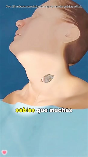 Cervical Discectomy Procedure (3D Animation)#cervicaldiscectomy#3danimation #Health #didyouknow