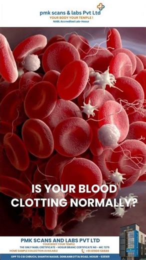 🩸 Coagulation Profile Test – Know Why Your Blood Clots!
