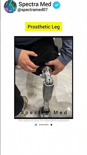 How a High Tech Bionic Leg Attaches Inside an Above-Knee Prosthesis #science #biology
