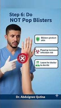 10- Minor Burn First Aid – Quick Life-Saving Steps 🩹⚡