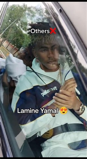 OTHERS VS ME☠️ #foryou #shorts