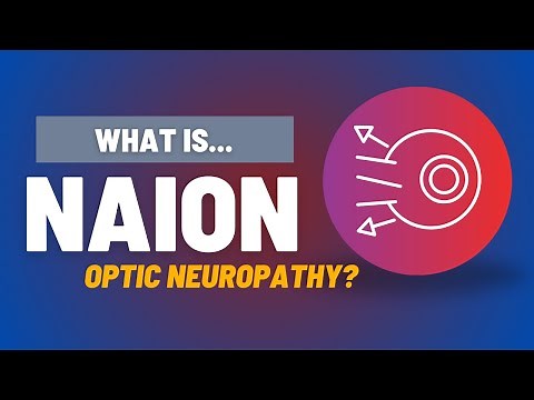 Sudden Vision Loss? Know the Signs of NAION 👁️