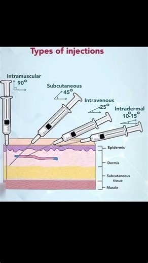 Types Of Injections ✓