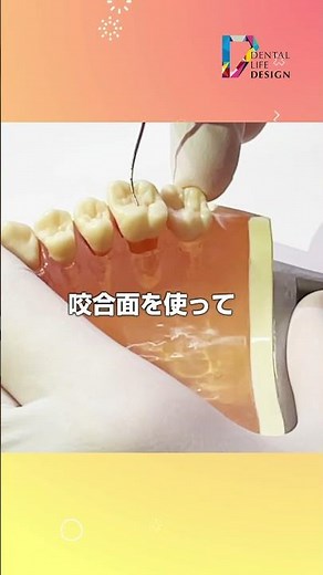 [How to measure root furcations with a furcation probe] Dental knowledge you can't ask now. Consu...