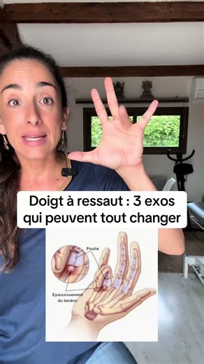 Je te montre 3 exos qui peuvent nettement améliorer ton doigt à ressaut, pas toujours besoin de passer par l’infiltration! Je te propose ma prochaine conférence en ligne le 5 juin à 18h sur le thème de l’ARTHROSE. Le lien d’inscription est dans ma bio 😉
