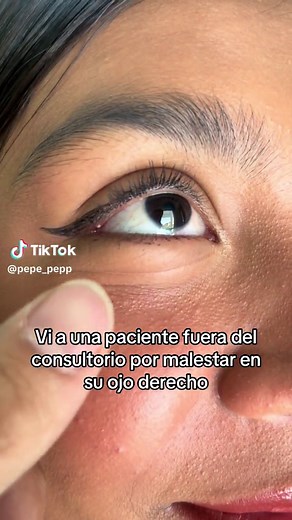 ORZUELO infeccion de las glandulas en el parpado #doctor #medicine #consultamedica #doctorexplains #salud #oftalmologia #pediatria #infeccion #orzuelo #parpados #maquillaje #pepe_pepp #fypシ #parati