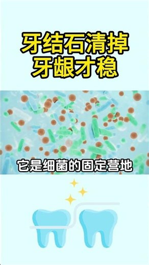 Remove calculus or lose your teeth #dental #warning