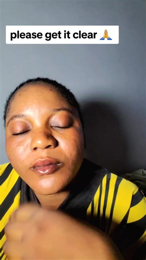 Understanding Red Eyes: Debunking Myths and Misconceptions