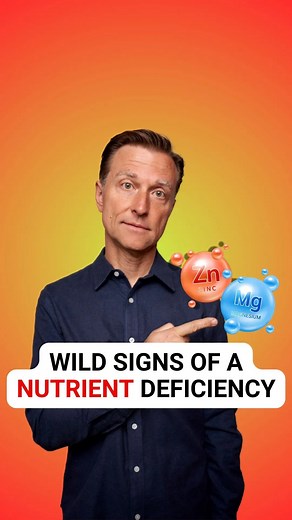 1.4M views · 36K reactions | The key symptoms of these common nutritional deficiencies are… For more health information you can't find anywhere else, click here: https://drbrg.co/4eSMgAJ | Dr. Eric Berg | Facebook