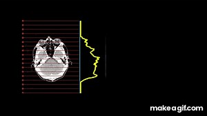 X-ray tomography sinogram build-up on Make a GIF