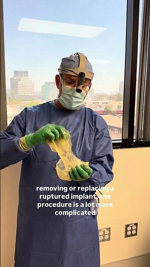 Dr. Hirsch explains how long breast implants last