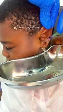 Excellent bain d’oreille / bouchon de cérumen /extraction