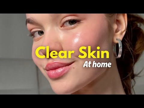 How To ACTUALLY Get Clear Skin & Get Rid of Your Acne