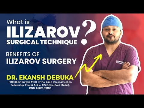 What is Ilizarov Surgery ? Technique and Benefits | By Dr. Ekansh Debuka | Orthopedics | Ranchi |.