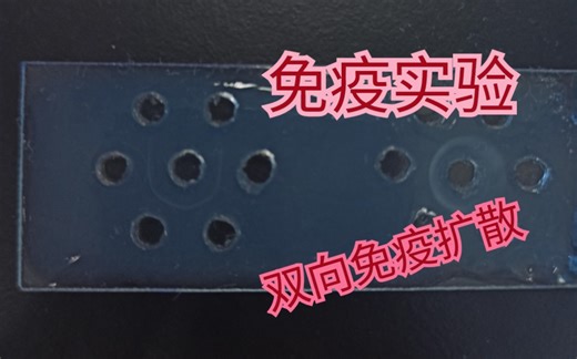 免疫学实验双向免疫扩散--人IgG检测