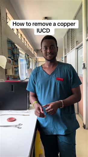 Effective Steps to Remove a Copper IUCD Safely