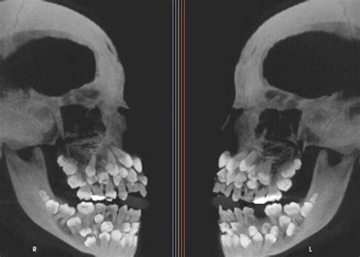 40 Photos Of Rare Body Features That Show Just How Unique Humans Can Be