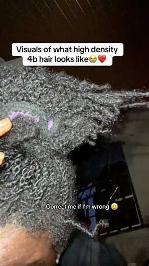 Understanding 4B Hair Type and Density