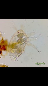 What are inside a nauplius larva? Speed 3x #unknown #nauplius #microscope #crustacean #zooplankton | Algaholic