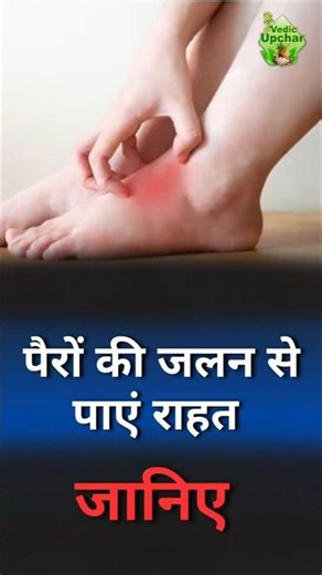 Burning Feet Syndrome | Causes, Symptoms & Home Remedies| Vedic Upchar | @anilbansalayurveda | #burn