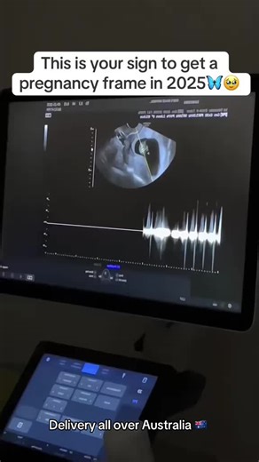 Link 🔗 in bio ✨Acrylic Digital Photo Frame • Uniqune Acrylic Design • 7”IPS screen #deliveryalloveraustralia🇦🇺 #australia🇦🇺 #auspost #linkinbio ##memories