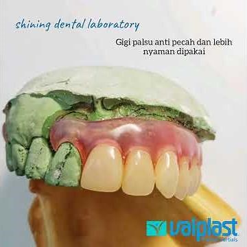 Valplast flexible denture