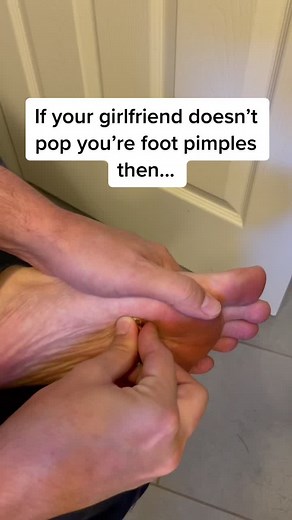 DIY Foot Pimple Popping Techniques | Tips for Clear Skin