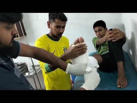 How To Apply Below knee cast / Short leg back slab in physeal fracture in distal tibia?