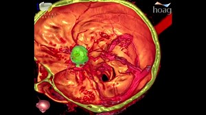 1.3K views · 36 reactions | Watch and learn more about the minimally...