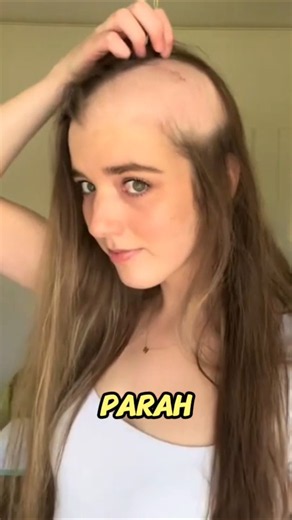 Causes of severe hair loss and how to treat it😱❓
