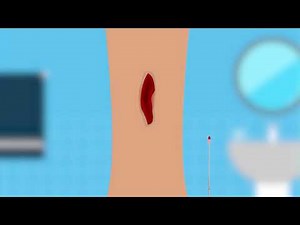 Wound Swab 1
