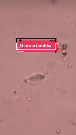 Understanding Giardia Lamblia Falling Leaf Motility in Parasitology Laboratory