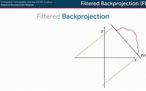 Filtered Backprojection (FBP)