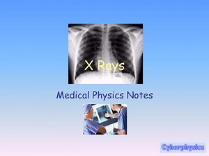 PPT - X Rays PowerPoint Presentation, free download - ID:4817290