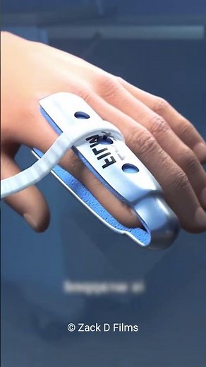 Curved Fingers: The Causes, Solutions & Surprising Truth