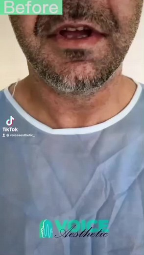 VoiceAesthetic_ TikTok'ta